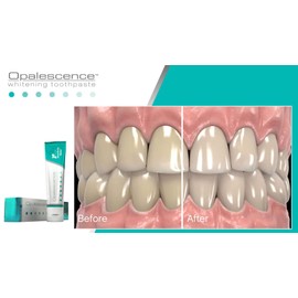 Opalescence Sensitivity Relief Whitening Toothpaste