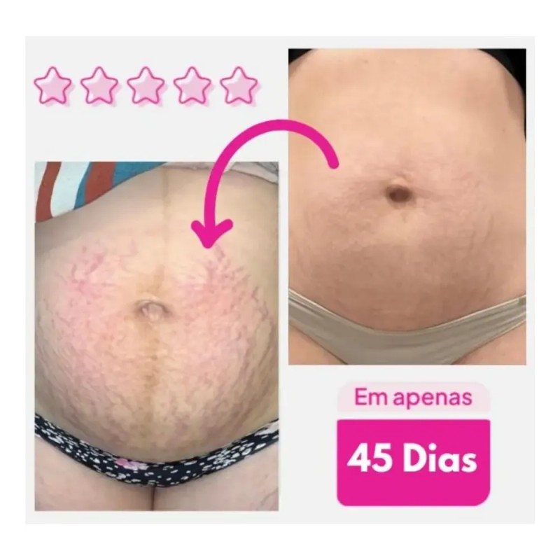 Fc 2026/adeus Tratamiento Intensivo Para La Piel S