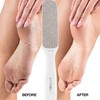 Probelle Double Sided Multidirectional Nickel Foot File Callus Remover -