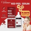 Venature Red Peel Serum, AHA BHA PHA, 30 ml, Deep