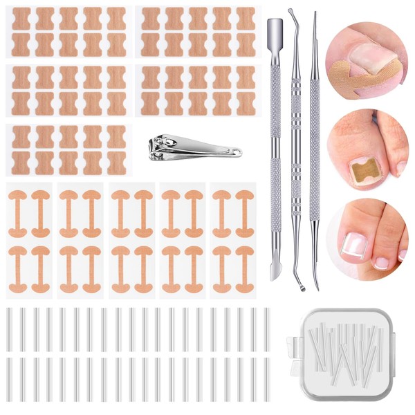 114 Pcs Ingrown Toenail Treatment Corrector, Ingrown Toenail Tool with