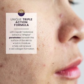 Mederma Pm Crema Intensiva Cicatrices Regenerativa Nocturna