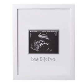 Tiny Ideas Sonogram Signature Frame - Ultrasound Picture Keepsake, Gender Neutral Baby Shower Decor, First Time Moms Pregnancy Gift, Guest Book Alternative, Ideal for Nursery, Marker Included