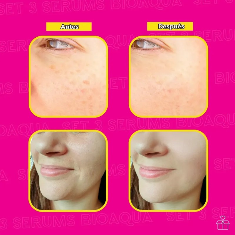 Kit Suero Vitam C+retinol+ac Hy Momento De Aplicación Día/noche Tipo