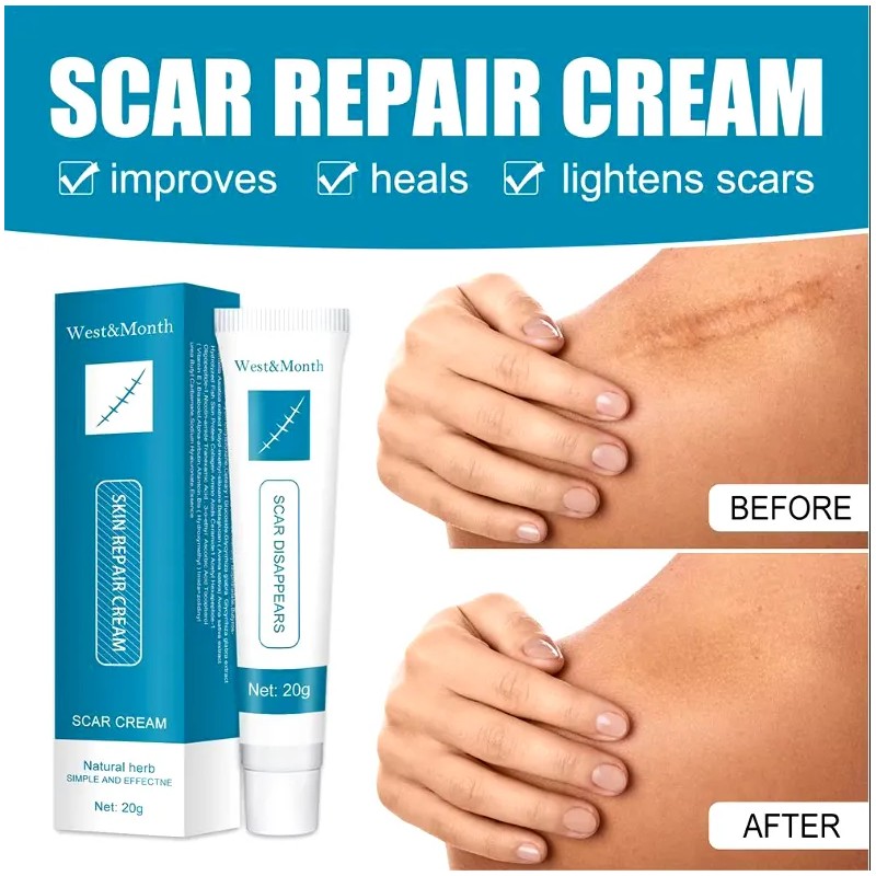 Crema Reparadora Para Cicatrices De Acné Y Estrías 20g Mixta