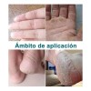 Artken Reparación Para Pies Agrietados Y Resecos - Crema