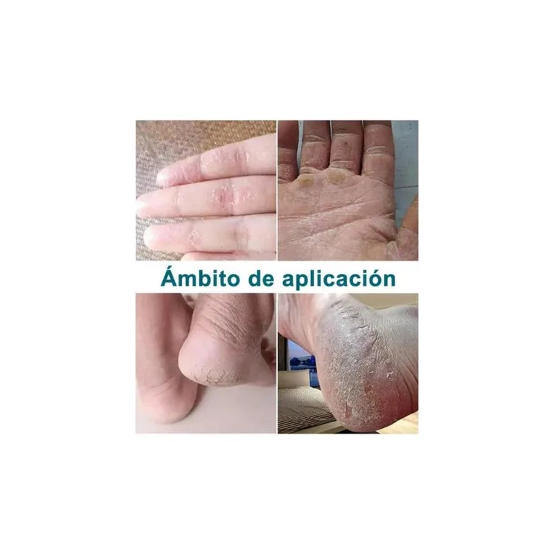 Artken Reparación Para Pies Agrietados Y Resecos - Crema
