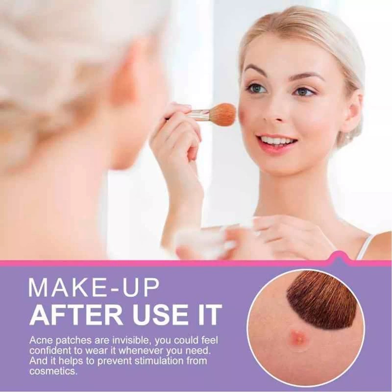 Veraly 24 Parches Acne Dia/ Noche Quita Acne Espinillas Tapa