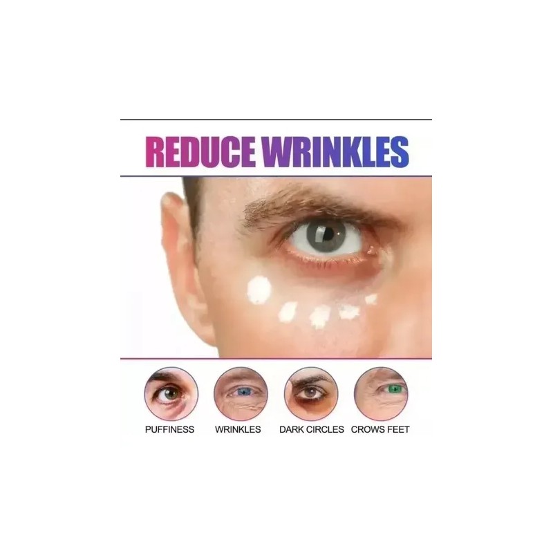 Serum Aclarante Manchas Acné Tratamiento Vitamina C 30m