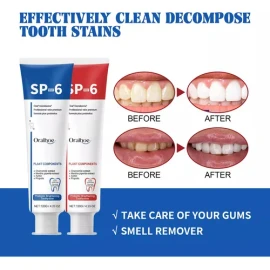 Oxyglow Sp-6 Whitening Toothpaste, Sp-6 Probiotic Whitening Toothpaste, Pasta De Dientes Para El Cuidado De La Limpieza Profunda, Aliento Fresco 120 G (2pcs)