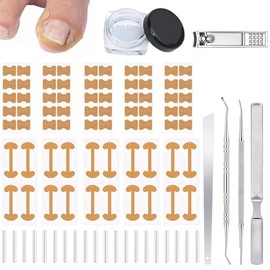 LUSCOR Kit Para Uñas Enterradas,Professional Ingrown Toenail Set,Pegatinas Para Uñas, Kits De Corrección De Uñas Para Eliminar Las Uñas Encarnadas, Al