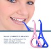 Clear Aligner Removal Tool by - Invisible Removable Braces QTY