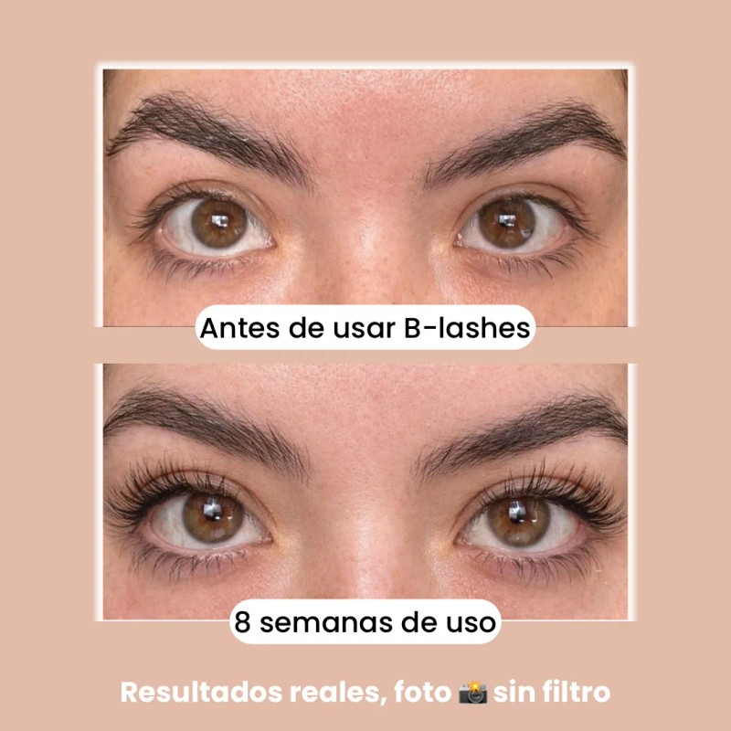 B-lashes Suero Crecimiento Pestañas Largas Origen Natural