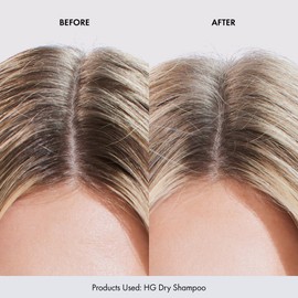 BondiBoost HG Dry Shampoo 3.95 oz / 112 g