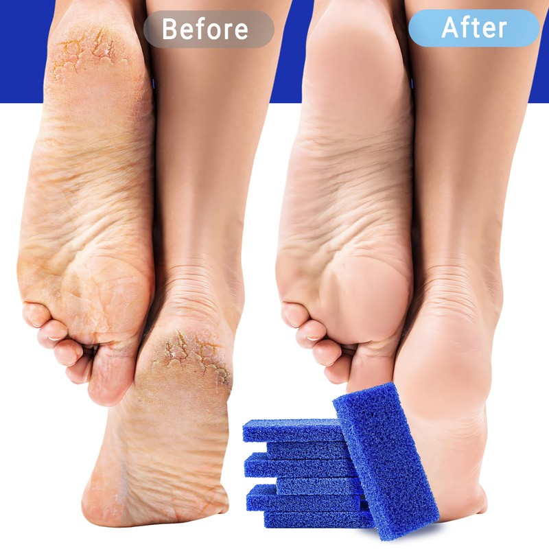 SALVMARY Disposable Pumice Stone for Feet Hard Skin Callus Remover