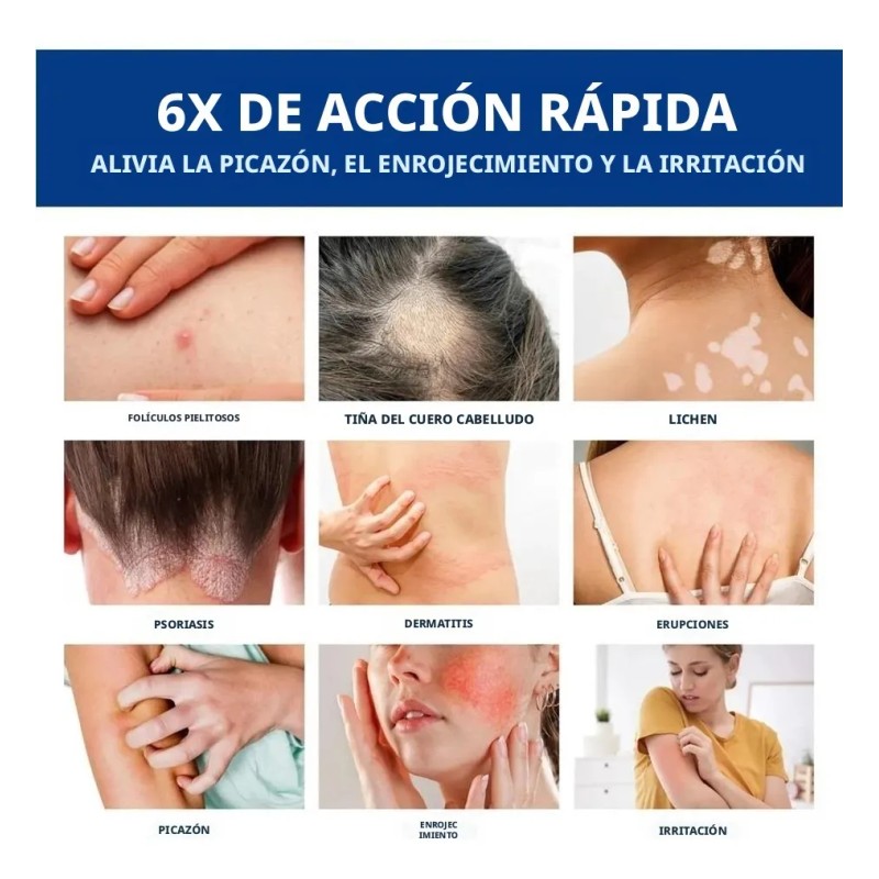 Bálsamo Reparador Calmante For El Cuidado Corporal /