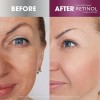 Retinol Skincare Ldel Cosmetics Crema De Día De Amplio Espec