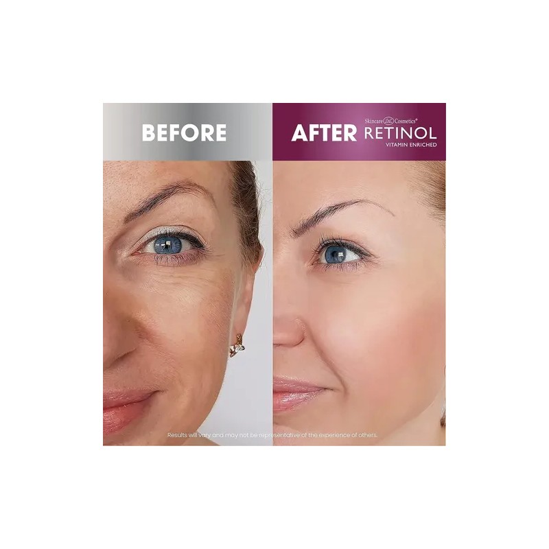 Retinol Skincare Ldel Cosmetics Crema De Día De Amplio Espec