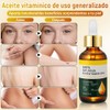 LUSCOR 2pcs Aceite De Vitamina E Para La Cara，Aceite Acondicionador