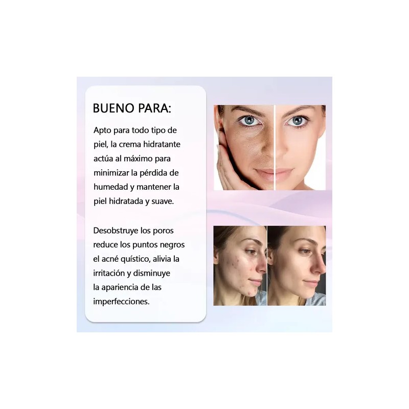Antiacné Clean Sebum Care Loción Secante Crema Hidratante