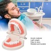 Dental Disease Caries Teeth Model Resin Simulation Teaching Prop Dental