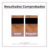 Crema Contorno De Ojos Eucerin Anti-pigment Anti-ojeras 15ml