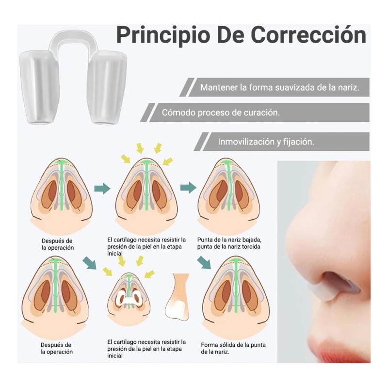 Kit 4pzs Retenedor Nasal Y Termoplástica Rinoplastia