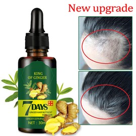 Hair Growth Serum, Hair Care Product, Hair Serum, Fast Hair Growth, Hair Growth & Hair Thickening,Stop Hair Loss, Grow Hair Fast, Hair Loss Treatment for Men & Women(30ml)
