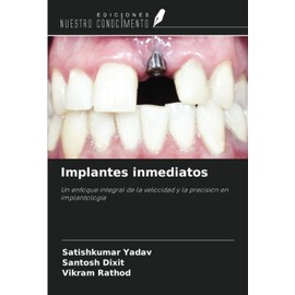 Implantes inmediatos: Un enfoque integral de la velocidad y la precisión en implantología