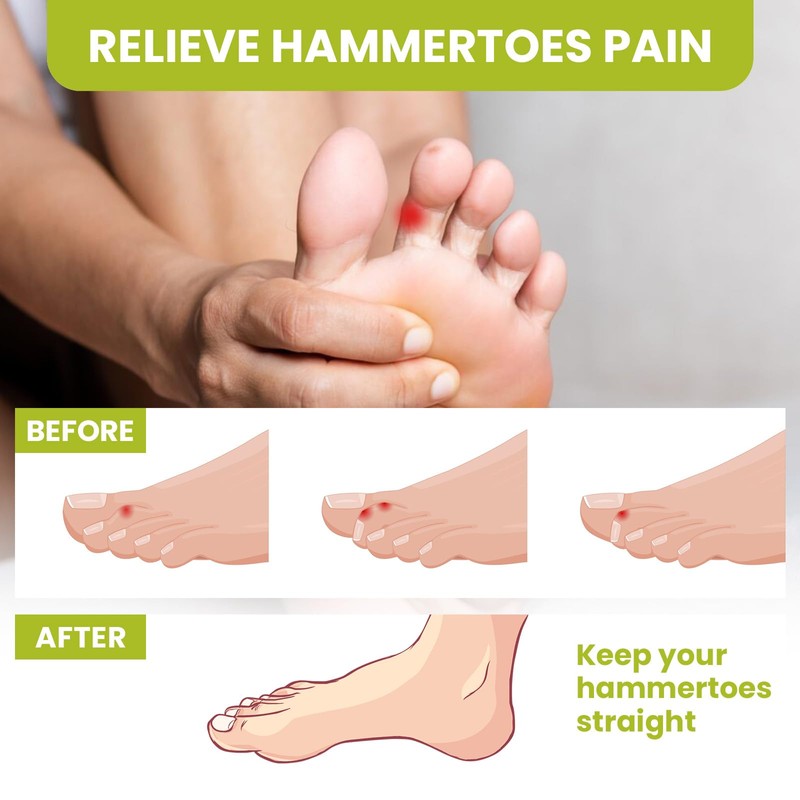 Bukihome Toe Separators, 4 Pair Soft Gel Toe Spacers to