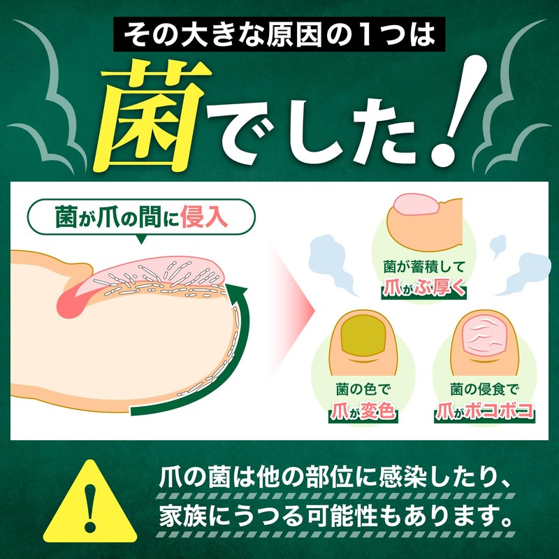 【指定医薬部外品】reglear 爪消毒ジェル 薬用消毒ジェル 爪ケア 足 爪 クリーム ケア 18ml 約1ヵ月分
