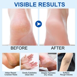 DMQ Urea Foot Cream, 2PCS Foot Cream for Cracked Heels and Dry Skin, Honey Cracked Heel Repair Cream, Urea Cream Foot Moisturiser (1.41 Ounce (Pack of 2), Aloe Vear & Honey)