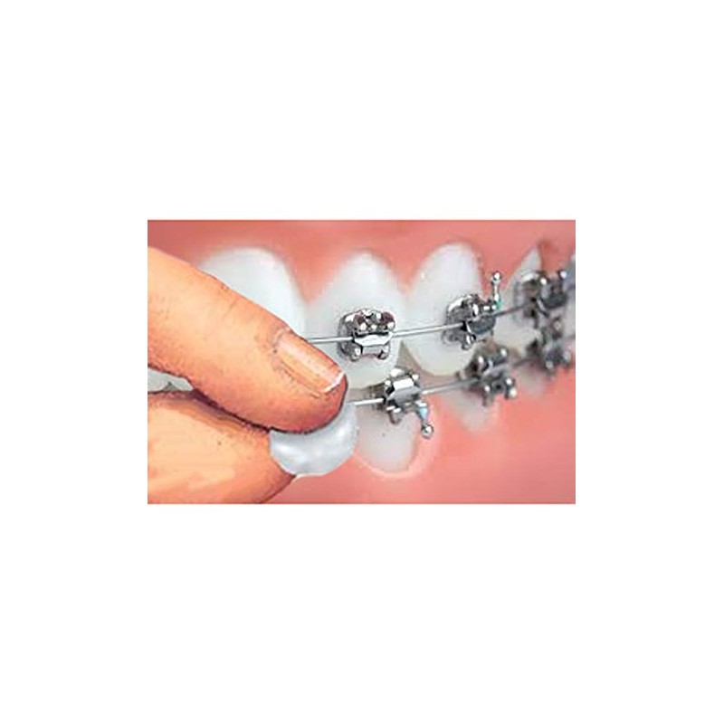 Orthowax - Cera de ortodoncia para usuarios de aparatos ortopédicos,