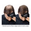 Universo en Linea Sevich Hairline Peine Optimizador De Fibra Capilar