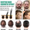 탈모 치료/머릿결개선/모발 강인화, 20ml, 1개 Hair Loss Treatment / Hair