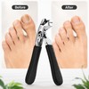 Nail Clipper Set for Thick Nails – Stainless Steel Wide