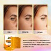 2PCS Jabón Turmeric Soap, Jabón De Ácido Kójico De Cúrcuma