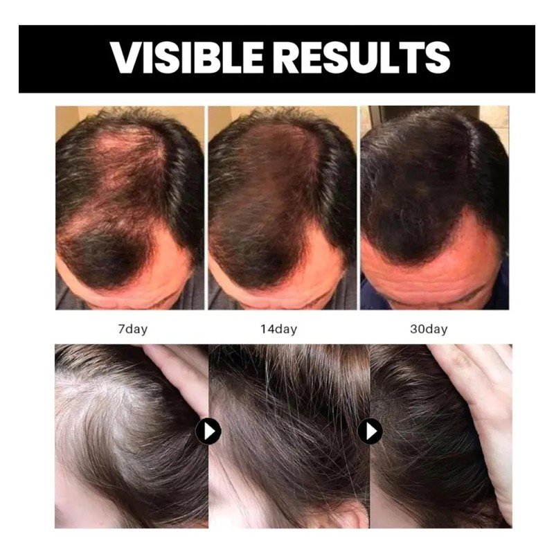 . 2*el Aceite De Batana Promueve El Crecimiento Del Cabello