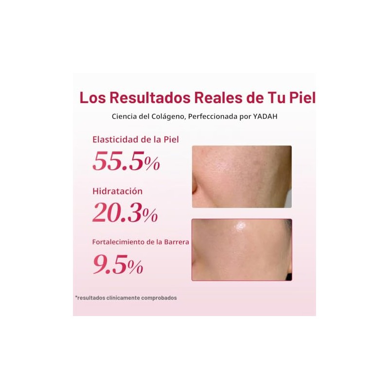 YADAH Crema Hydra Core con colágeno (50 g): hidratación, cuidado