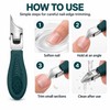Slant Edge Toenail Clipper Set for Thick Nails – Stainless