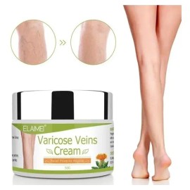 50 Ml De Pomada For Varices Elimina Las Estrías Rojas .