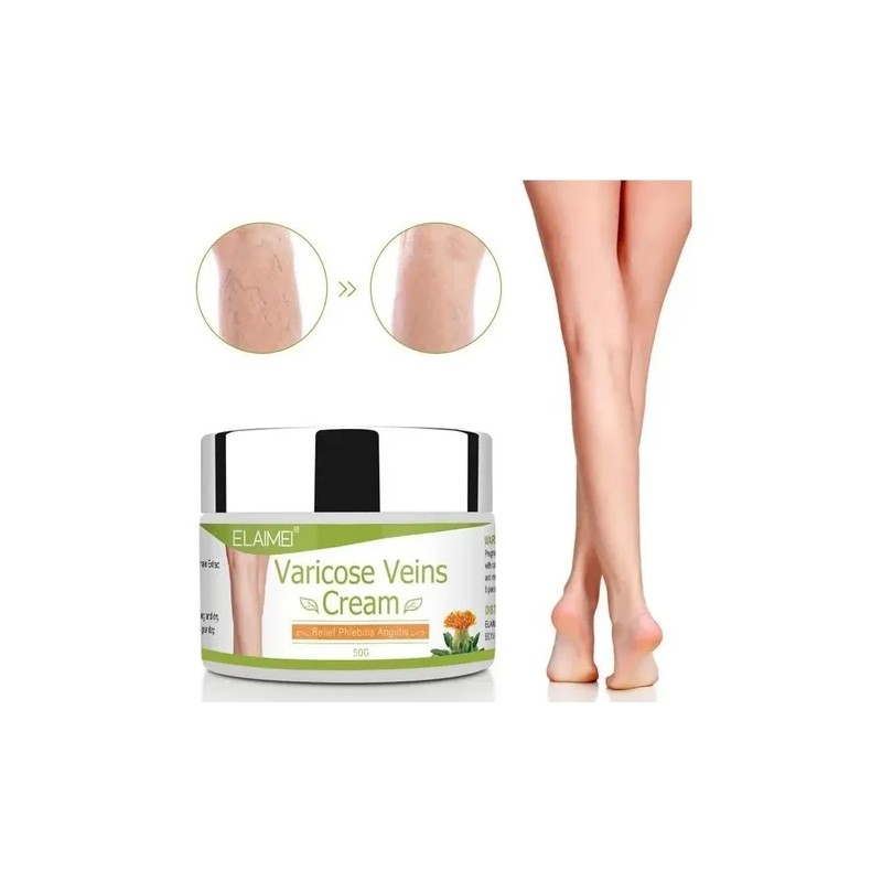 50 Ml De Pomada For Varices Elimina Las Estrías Rojas
