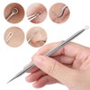 Blackhead Removal Tool Set – 5 Pcs Stainless Steel Extractor