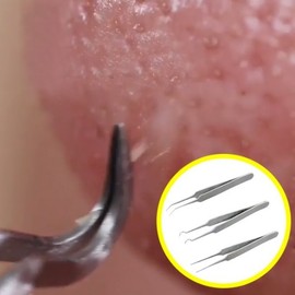 Blackhead Removal Tweezer 3-piece Hook-shape 3ea