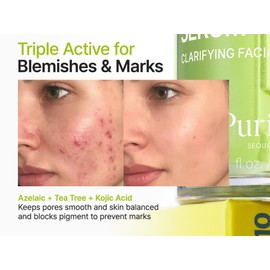 Purito Seoul [Purito Seoul]Azelaic Acid 10 Kojic Azulene Serum 30ml