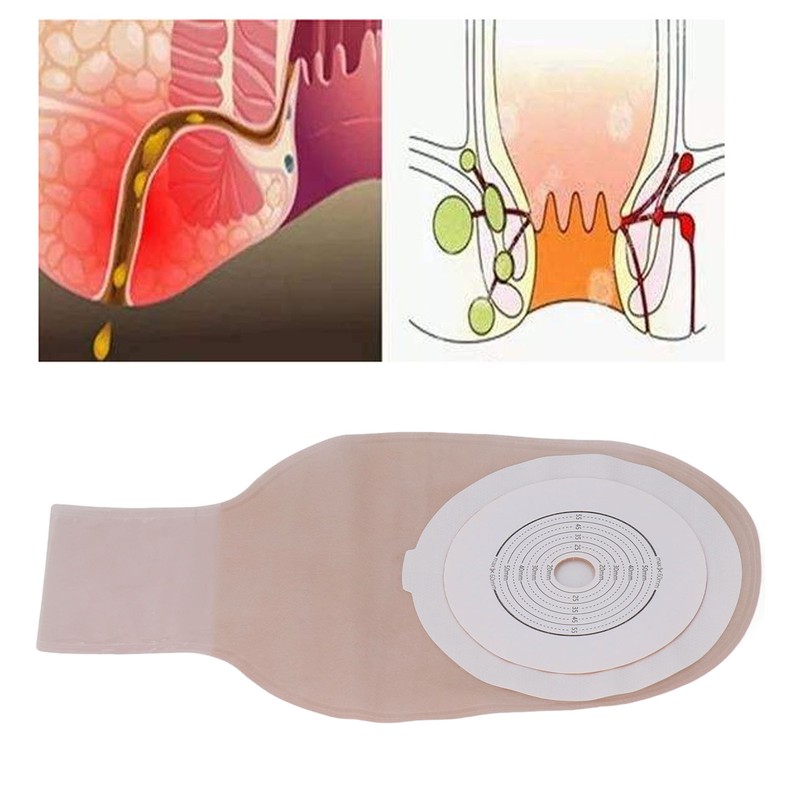 10pcs Colostomy Bags Leak Proof Safe Comfortable Portable Ostomy Pouch