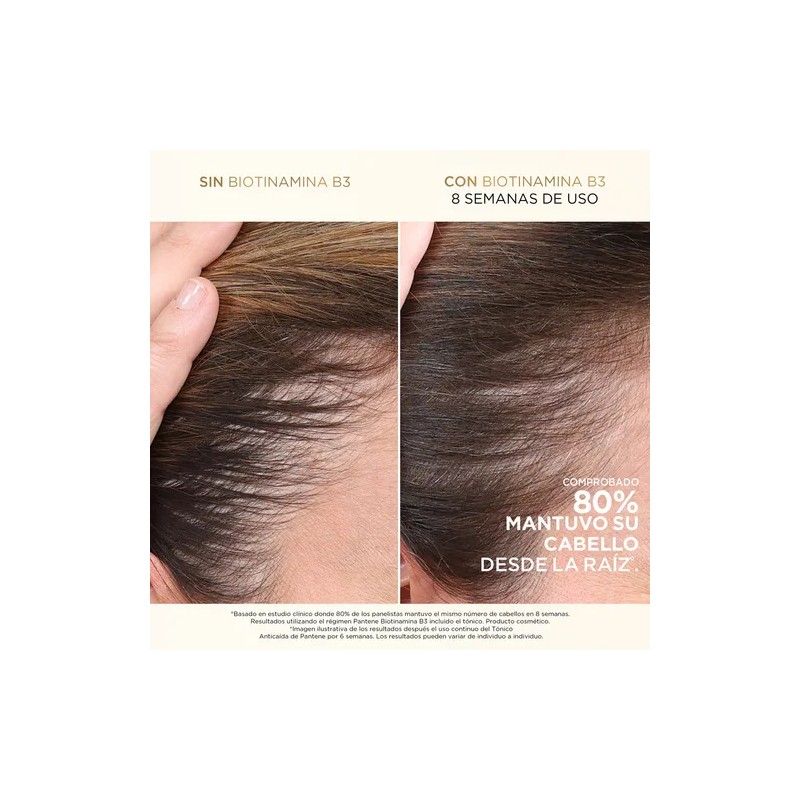 Shampoo Pantene Anticaída+ Biotinamina B3 510 ml