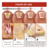 & [100 Parches Antimicóticos Para El Tratamiento De Hongos E