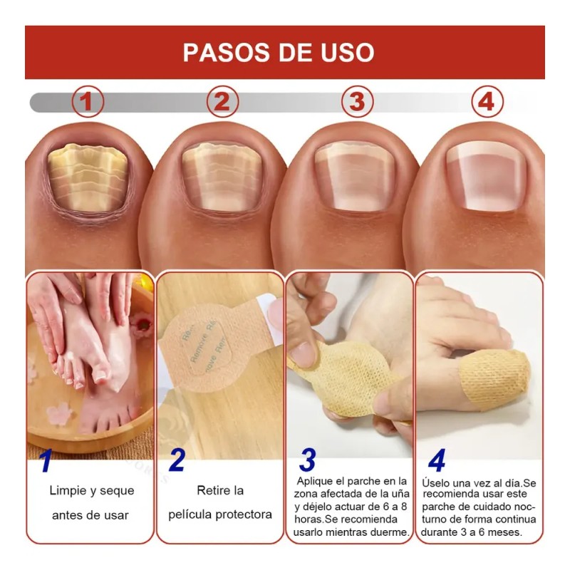 & [100 Parches Antimicóticos Para El Tratamiento De Hongos E