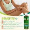 Aloe Life Skin Gel and Herbs, 8 Ounce